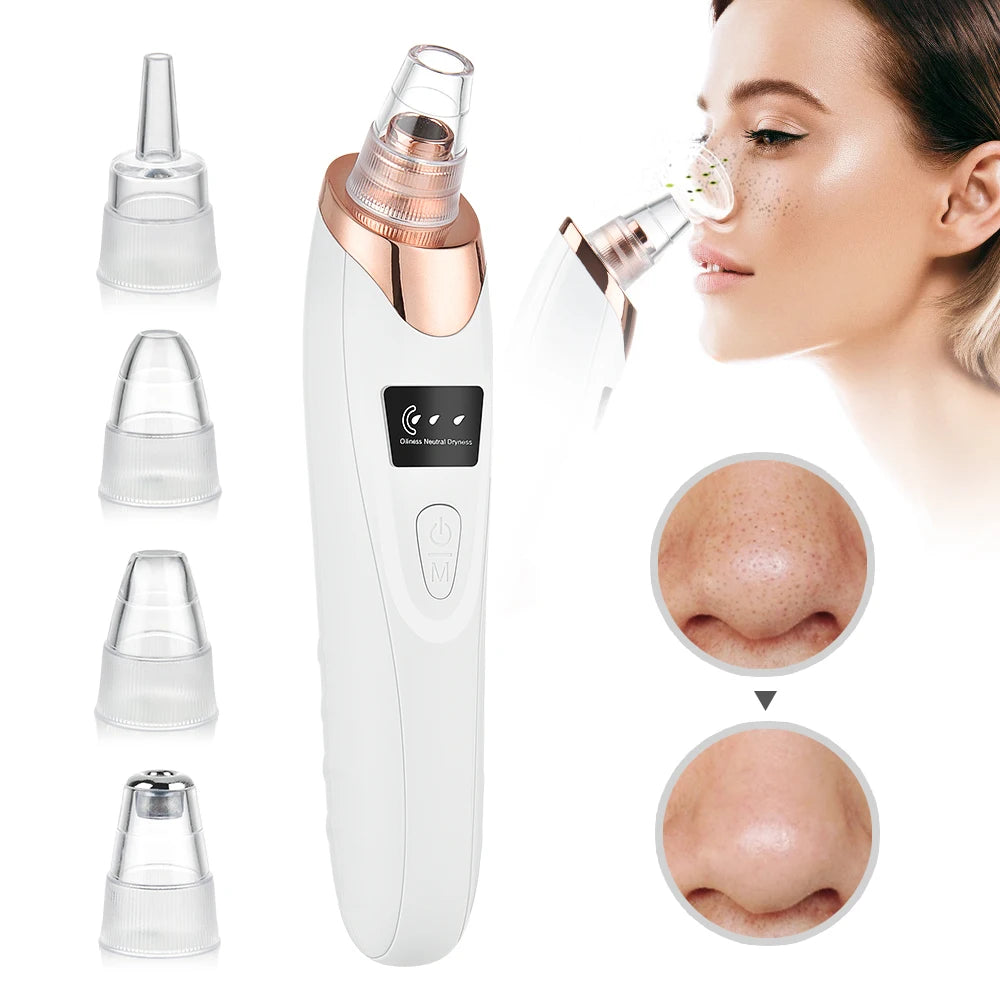 Blackhead Remover Pore Vacuum - USB Rechargeable Facial Pore Cleaner Kit